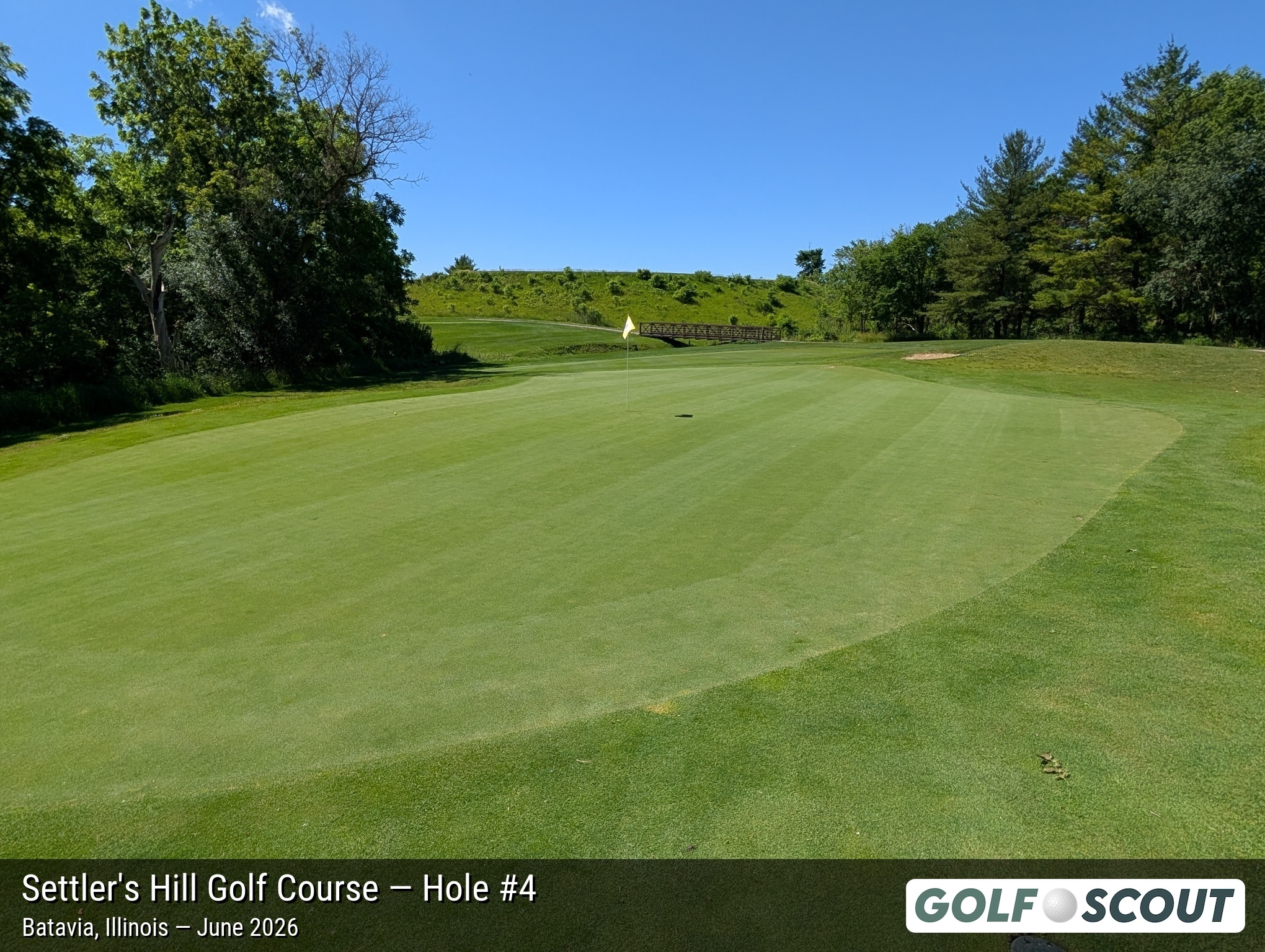 Hole 4 at Settler's Hill Golf Course